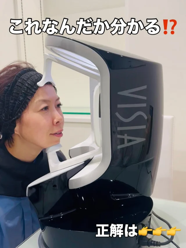 美容医療をもっと身近に❣️気軽に‼️
と、より思える機器が入ったと聞き👂✨
カズキプライベートクリニックに行ってきました💨

クリニックだからこそ扱える
医療機器 肌診断VISIA（ビジア）は
カラー写真とUV写真で顔を撮影して
自分の肌状態が分析できるとのこと。

目ではわからないシミやシワなどの肌トラブル、
肌年齢までもが画像から解析することができちゃいました😳

◯どの治療が自分に合うのか知りたい
◯自分の肌状態を知りたい
◯隠れジミや小ジワを事前に把握して予防したい
◯ニキビ治療をしているがなかなか改善しない

自分の肌質を客観的に診断してもらうのは
正直少しドキドキしたけど、診断した事で
今後の治療や自分で何をしたらいいのかがわかり
すごく参考になった😊

VISIAを試してみたい
美容医療に興味があるけど初めて
という方は特に！
まずはVISIAから試してみるのもいいかも😁

気になった方はインスタを見てみるか
@kazuki_prcl 

LINEで問い合わせしてみてね
https://line.me/R/ti/p/@401wfpfq
👆この画面をスクショしてアルバムにある画面を
長押しするとコピペできるよ😉

#美容医療 #肌診断 #visia #山陰 #島根 #松江 #カズキプライベートクリニック #行ってみた #pr #荒木まどか #ローカルタレント #パワフルmc #美容